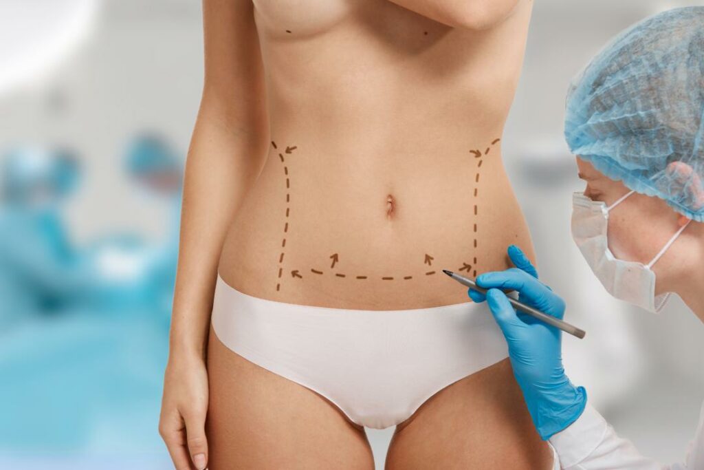 Get an Affordable Liposuction Cost in Turkey 2023