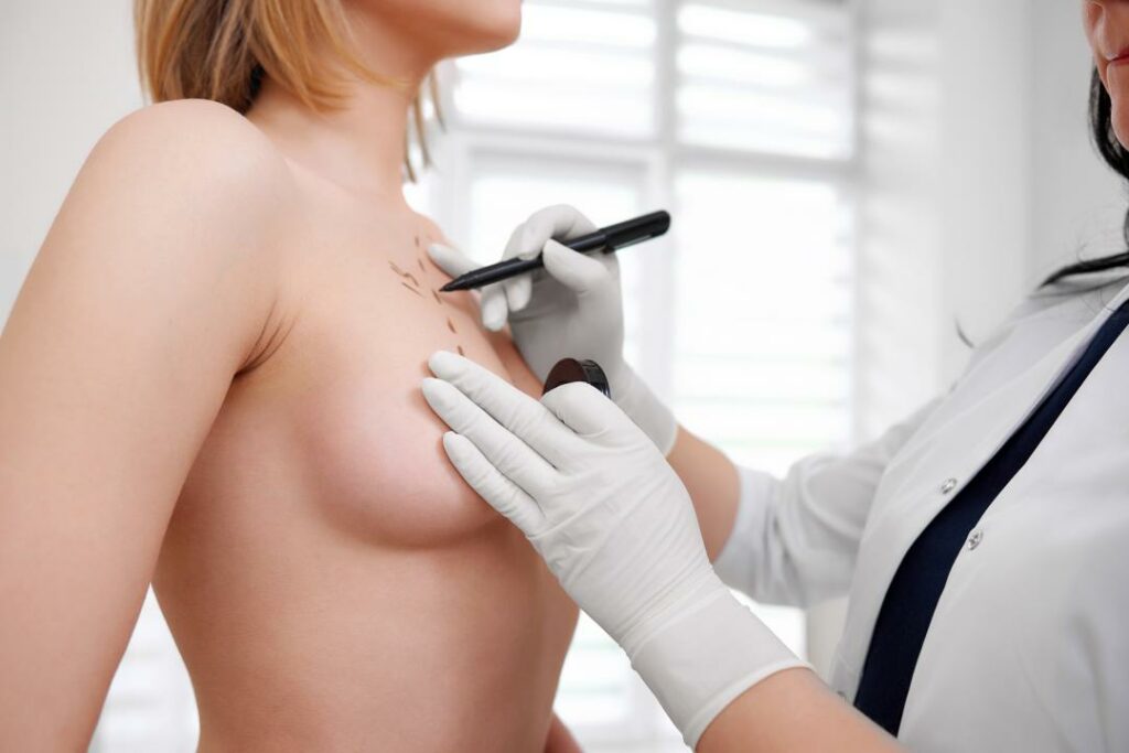 The Ultimate Guide to Breast Reduction Surgery Cost: Why Turkey is the Best Option in 2023?