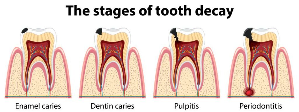 Parts of a Tooth: Unlock the Marvel of Tooth Anatomy in 2023