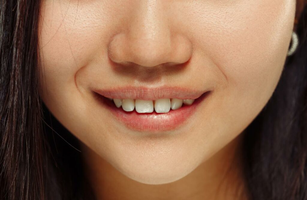 Unveiling the Mystery of White Spots on Teeth: Causes, Treatment 2023